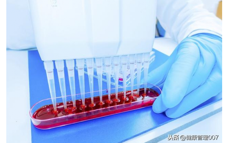 上?？諝鈾z測(cè)項(xiàng)目清單及費(fèi)用